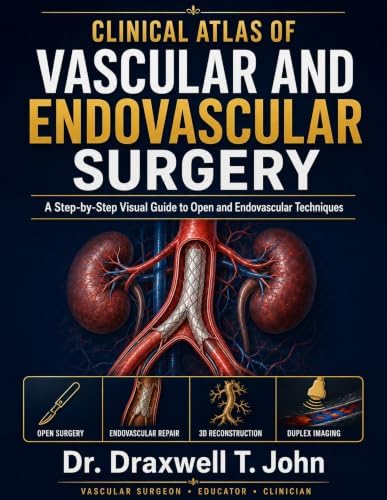 Amazon.com: ATLAS OF VASCULAR SURGERY AND ENDOVASCULAR THERAPY: An